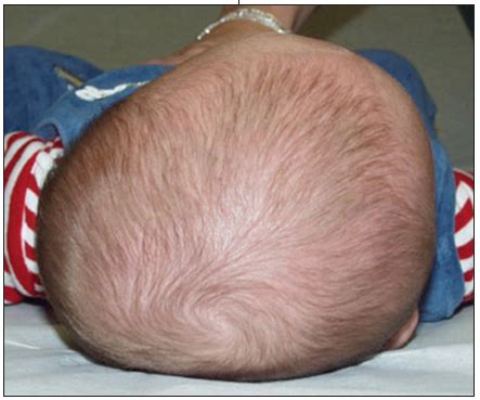 weird shaped head|odd shaped skull.